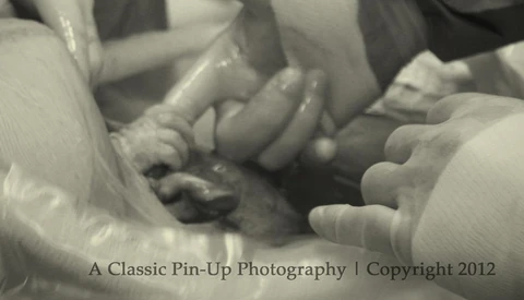 Photo of Baby Grabbing Doctor's Finger During C-Section Goes Viral