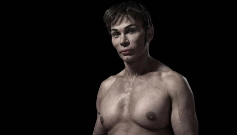 Portraits Of Extreme Plastic Surgery (NSFW)