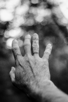 Open palm of a weathered hand held up to camera with blurred foliage background.