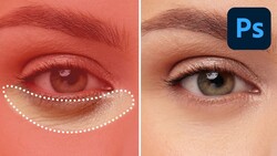 Before and after comparison of under-eye retouching in Photoshop, showing redness and swelling removal.
