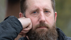 Bearded man with hand raised to face, wearing dark jacket, looking directly at camera with serious expression.
