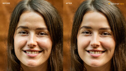 Before and after skin retouching comparison showing reduced blemishes and smoother complexion.