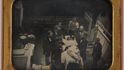 Early daguerreotype of surgeons gathered around a patient on an operating table in a tiered surgical theater.