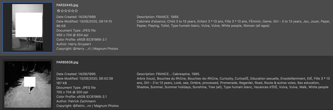 Children tagged with the keyword "vulva"