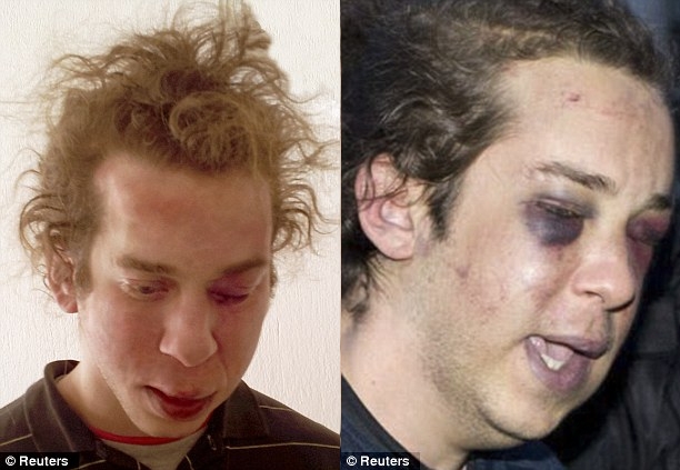 Greece-torture-before-after-2