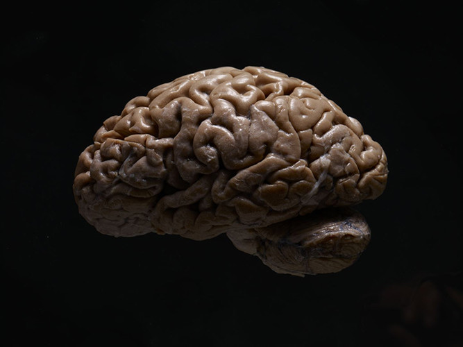 AdamVoorhes_Brains01