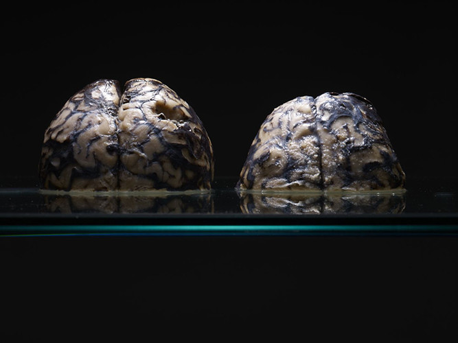 AdamVoorhes_Brains02