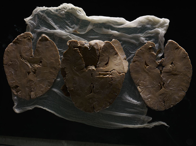 AdamVoorhes_Brains04