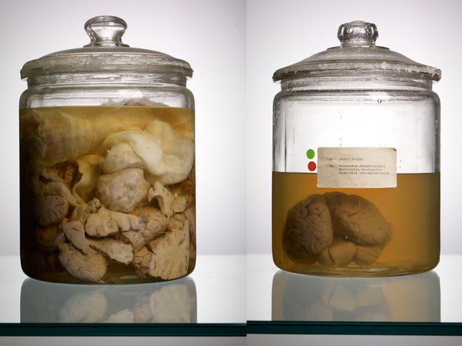 AdamVoorhes_Brains05