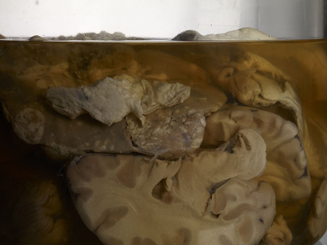 AdamVoorhes_Brains07